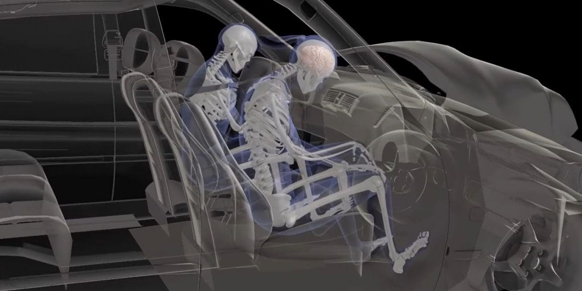 Animation accident biomechanical keynote